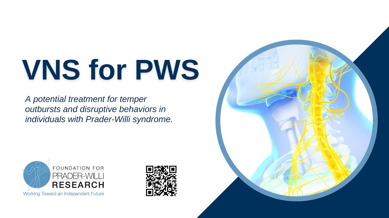 Vagus Nerve Stimulation For Behaviour In PWS